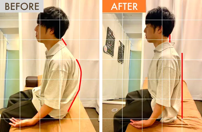 施術後に姿勢が改善されます