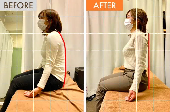 施術後に姿勢が改善されます