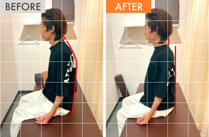 施術後に姿勢が改善されます