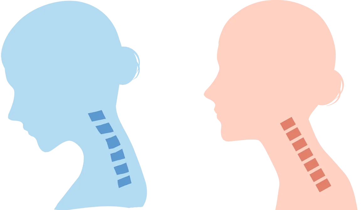 猫背やストレートネックで筋肉が固くなる