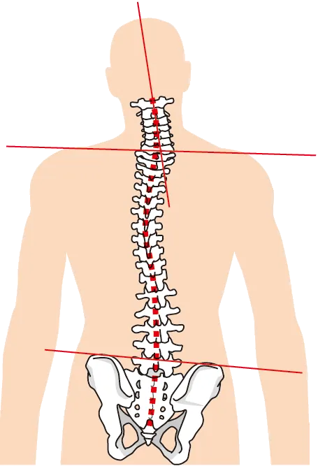 インナーマッスルが低下すると骨格が歪みやすいです